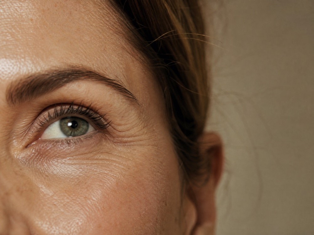 Huid na een skin booster-behandeling — Huidtextuur